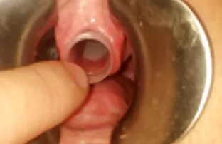 XXX 玛丽莲*钱伯斯博士.罗恩*杰里米. 性别毛茸茸的复古