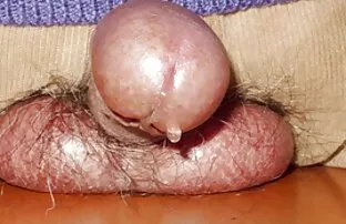 XXX 女同性恋，仔细拉屎手淫 毛茸茸的线控制动裸体